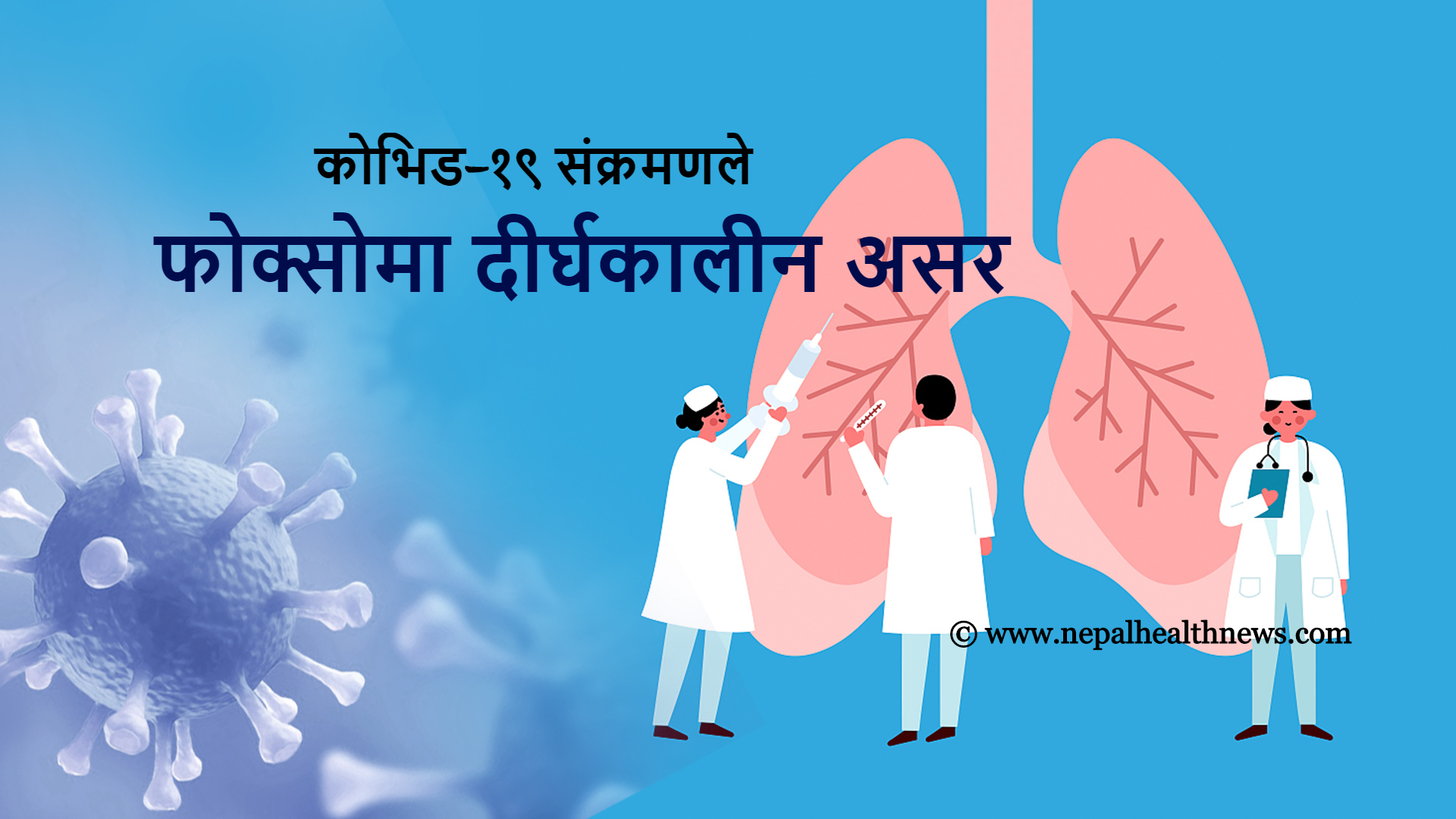 कोभिड-१९ संक्रमणले फोक्सोमा दीर्घकालीन असर देखियो-अध्ययन