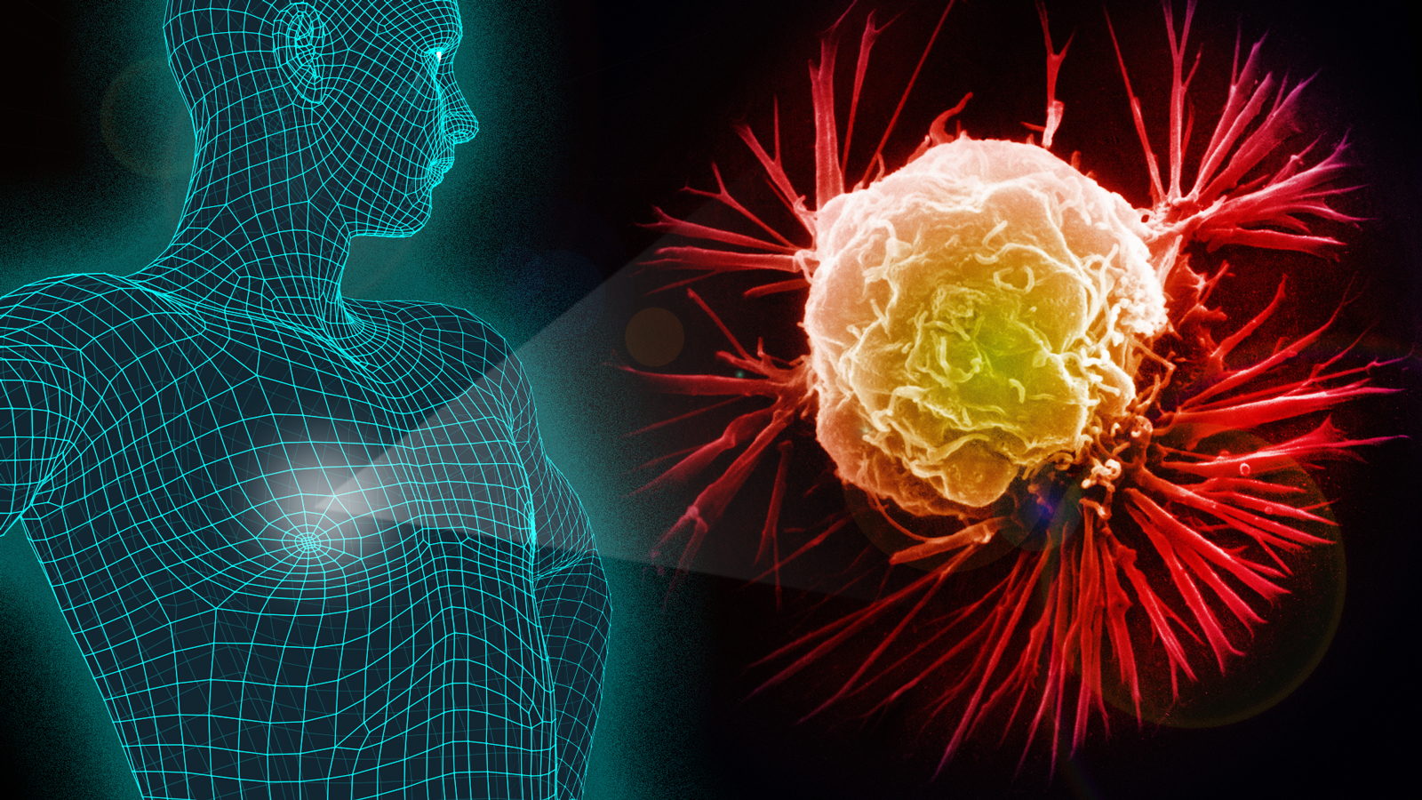 क्यान्सर : चुनौति चुलिँदै