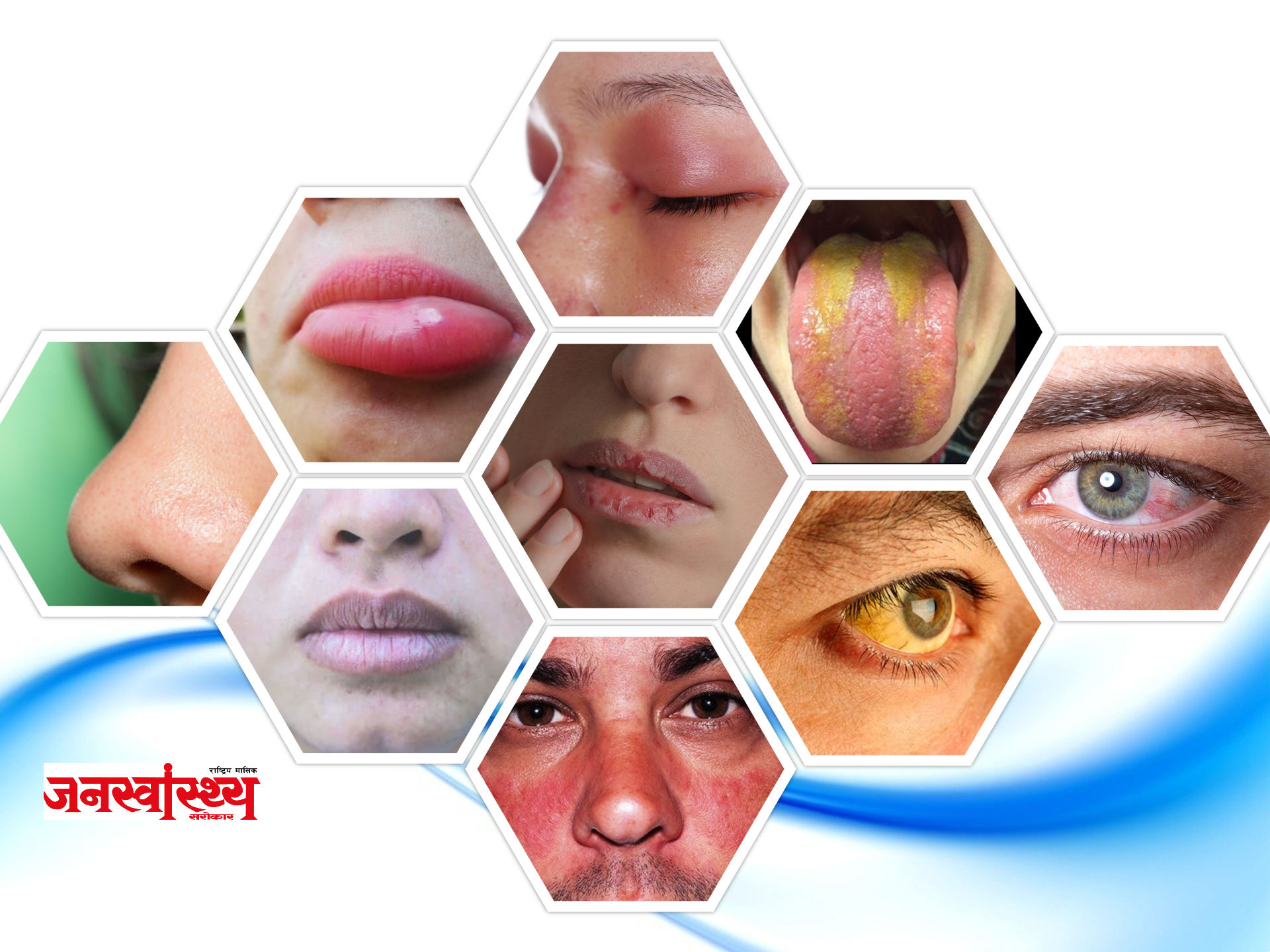 अनुहार हेरेर रोगको पहिचान !!! कुन अंगले के को संकेत गर्छ ? पढ्नुस त