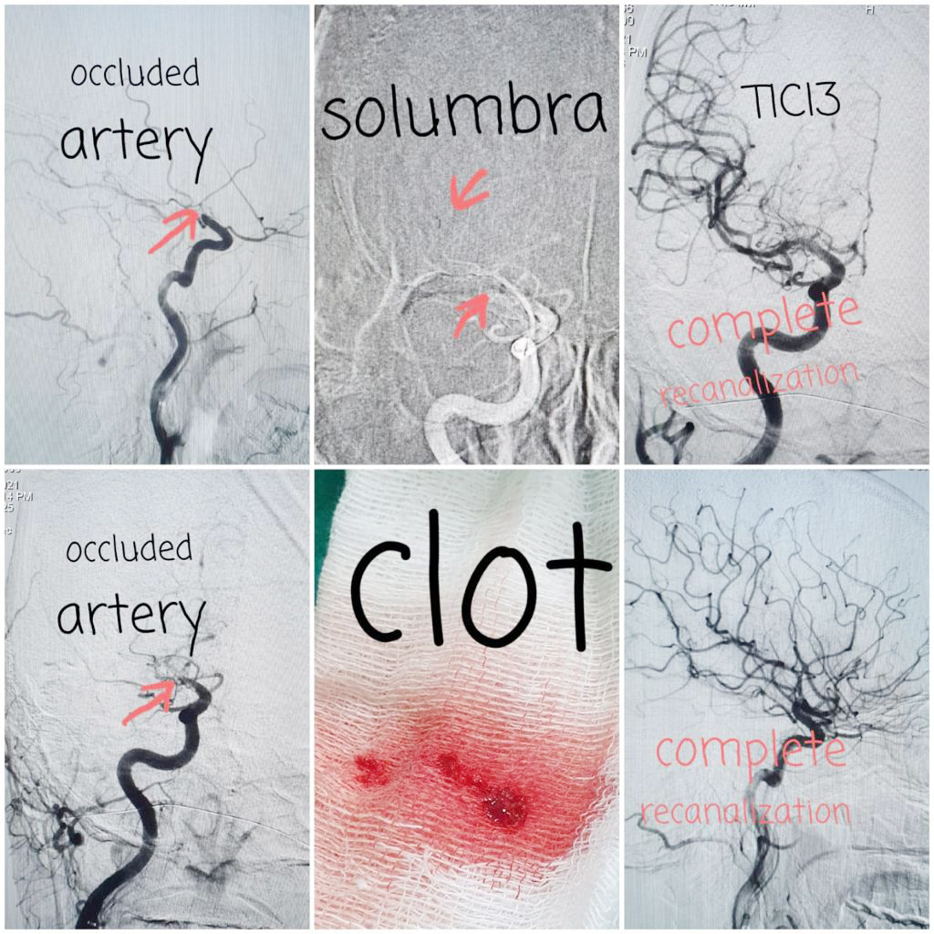 प्यारालाईसिस हुनबाट यसरी जोगिए अर्जुन !!