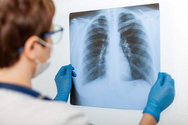 आज विश्व रेडियोग्राफी दिवस मनाइदैँ