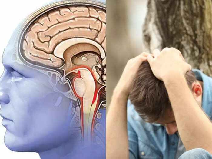 तीन चौथाइ छारेरोगी उपचारको पहुँच बाहिर ! दश जनामा एक जना छारेरोगी