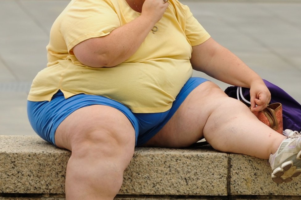 सन् २०३५ सम्ममा विश्वको आधाभन्दा बढी जनसंख्याबढी तौलको वर्गमा पर्ने चेतावनी-विश्व मोटोपन महासंघ