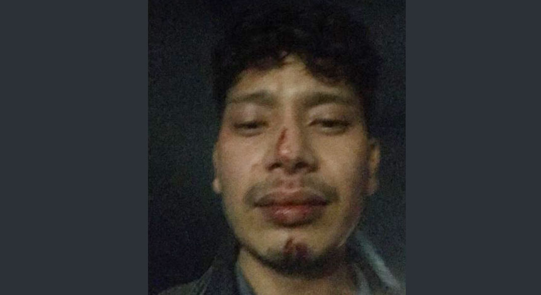 डाक्टर कुट्ने ५ जना प्रहरीलाई विभागीय कारवाही