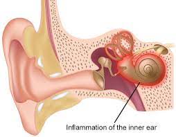 उफ ! मलाई रिंगटा लाग्यो