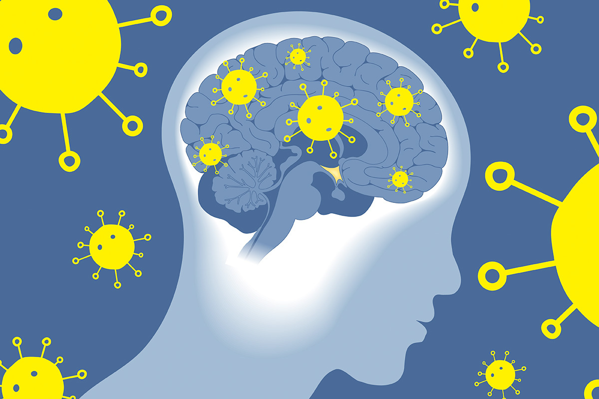 कोभिड–१९ सम्बन्धित मस्तिष्कजन्य रोगबाट जापानमा १० प्रतिशत बढी बालबालिकाको मृत्यु