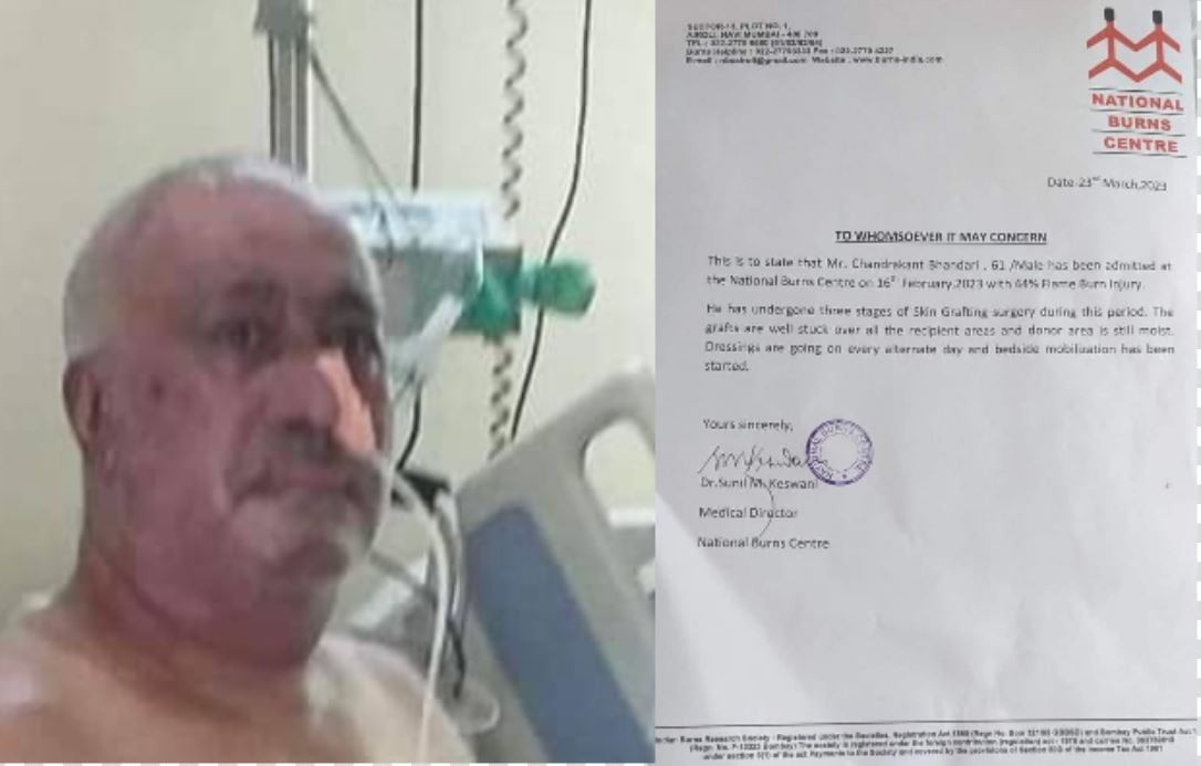 कांग्रेस नेता डा भण्डारीको स्वास्थ्यमा क्रमिक सुधार