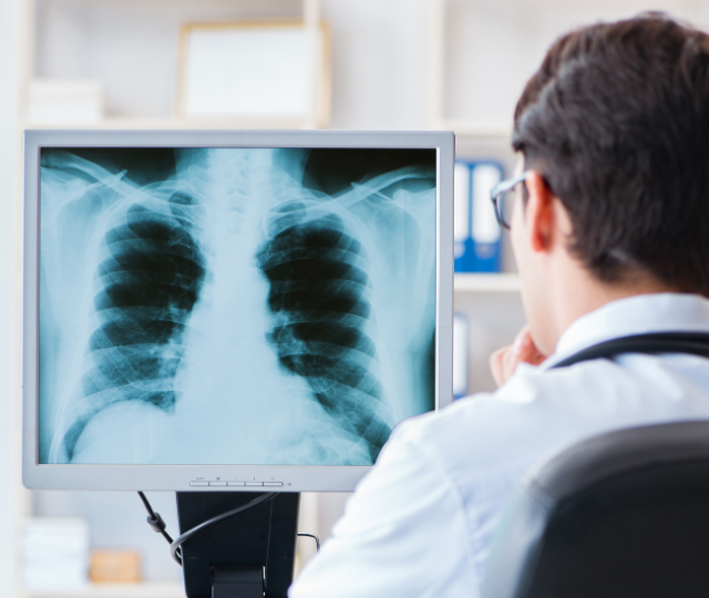 जनशक्ति अभावमा भिडियो एक्स–रे मेसिन प्रयोगविहीन