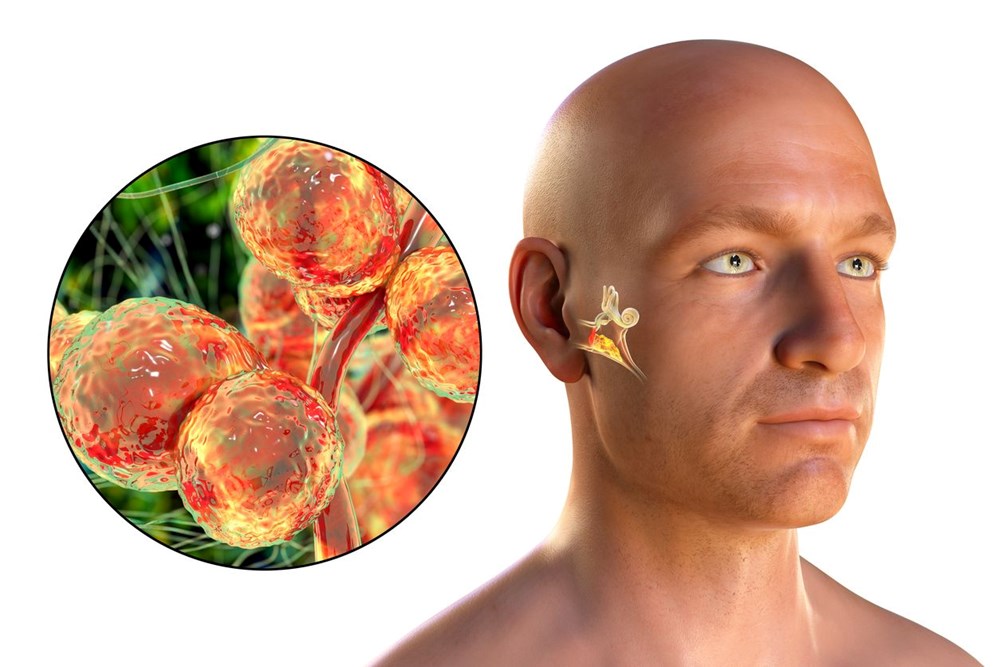 क्यान्डिडा औरिस : औषधिले काम नगर्ने फङ्गस, कसरी बच्ने ?