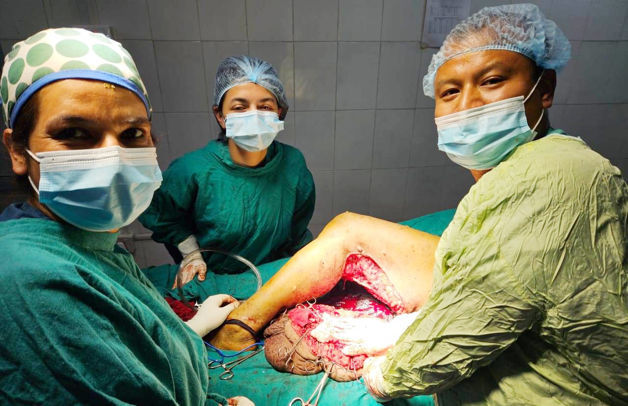 डा. कैलाश भण्डारीको टिमले बेनीमा ५ केजीको न्युरोफाइब्रोम्याटोसिस ट्युमर निकाल्यो