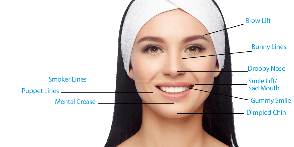 अनुहारको चाउरिपना हटाउन बोटक्स विकल्प ! कसले प्रयोग गर्ने कसले नगर्ने ?