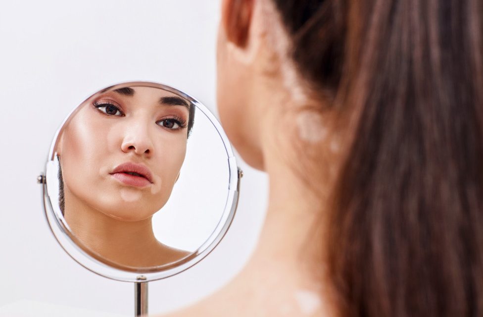 सेतो दुवीमा मेलानोसाइट्स प्रत्यारोपण