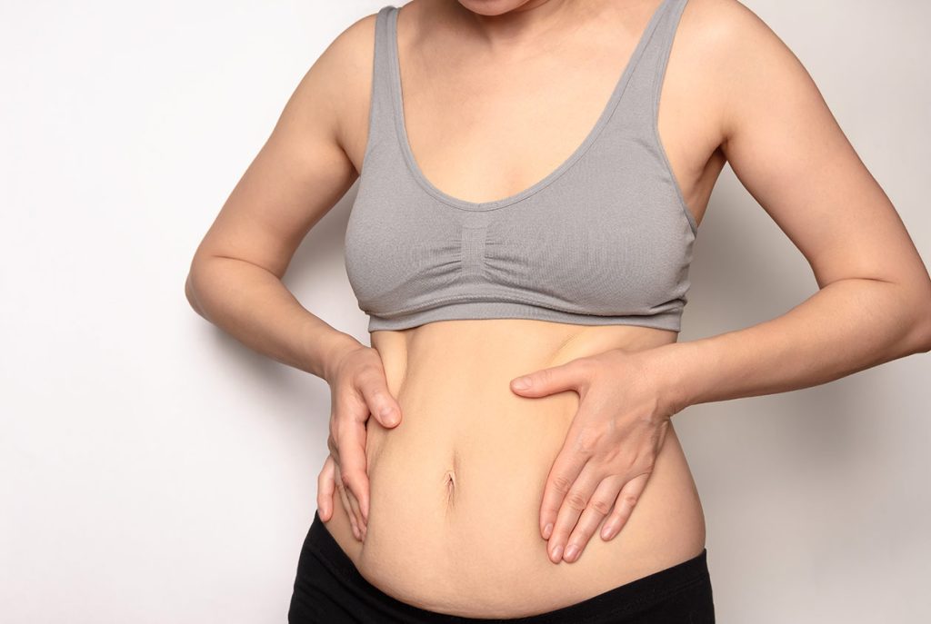 शरीरको आकार सुन्दर बनाउने सर्जरी ‘लिपोसक्शन’ : कत्तिको सुरक्षित ?