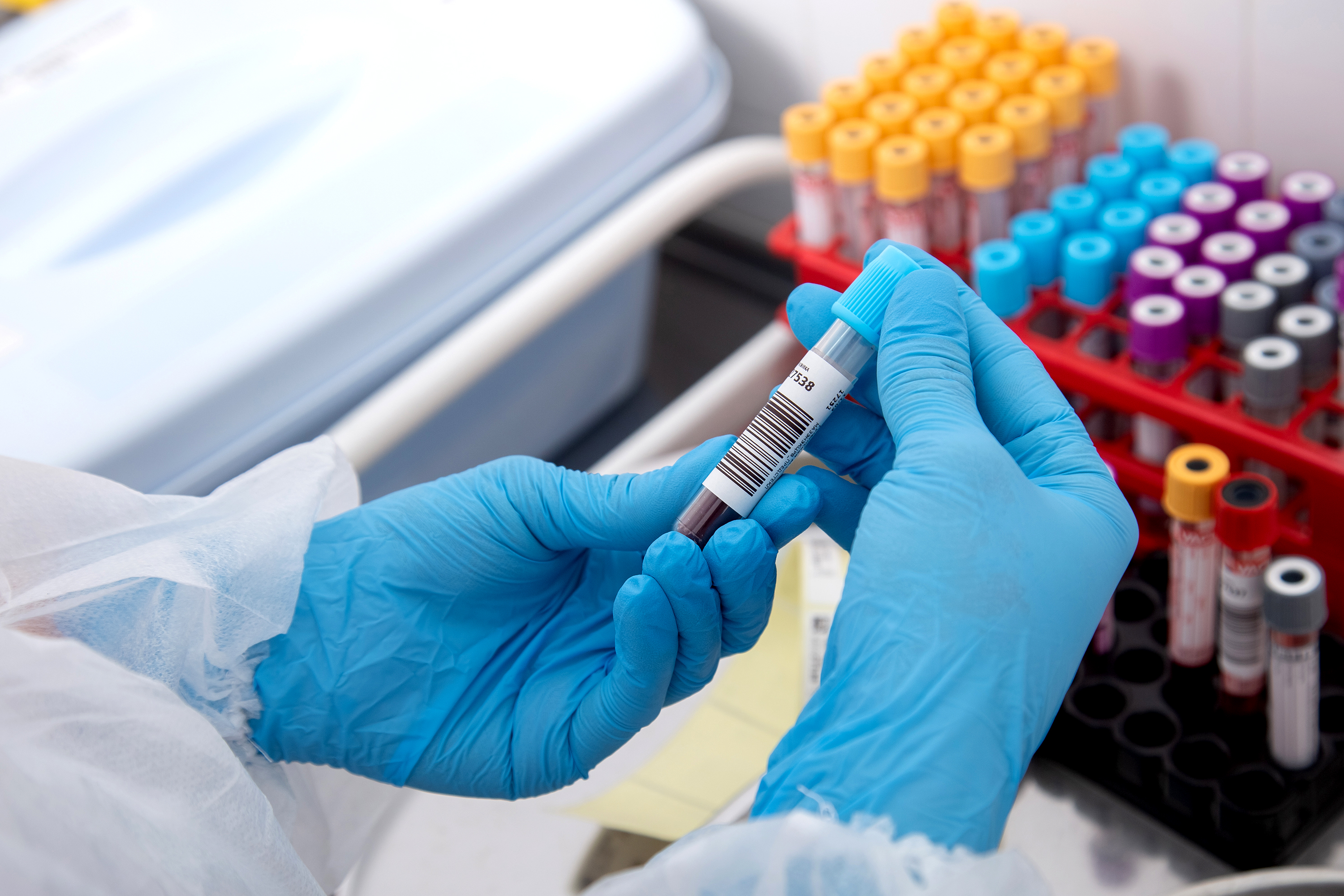 शरीरको कुनै अङ्ग चाँडै बूढो भएको पत्ता लगाउन सकिन्छ ?