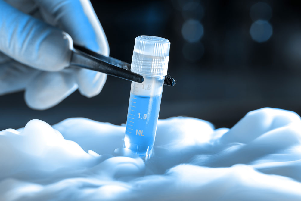 विवाहपूर्व नै डिम्ब र शुक्रकीट सुरक्षित राख्न चाहने महिला पुरुषको सङ्ख्या बढ्दै