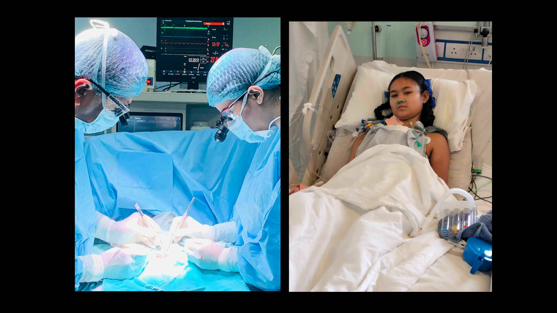 मुटुको जटिल र जोखिमयुक्त मानिने ‘डबल स्वीच’ शल्यक्रिया शहीद गंगालाल राष्ट्रिय हृदय केन्द्रमा सफल