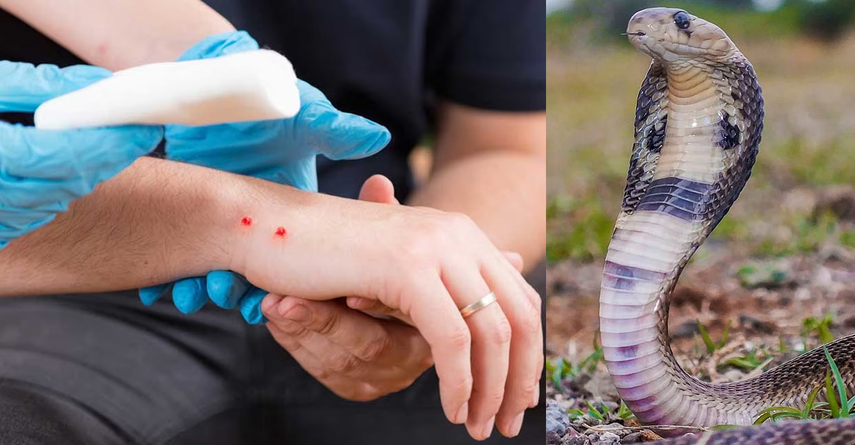 सर्पदंश: समयमै उपचार नपाउँदा १६ बिरामीको मृत्यु