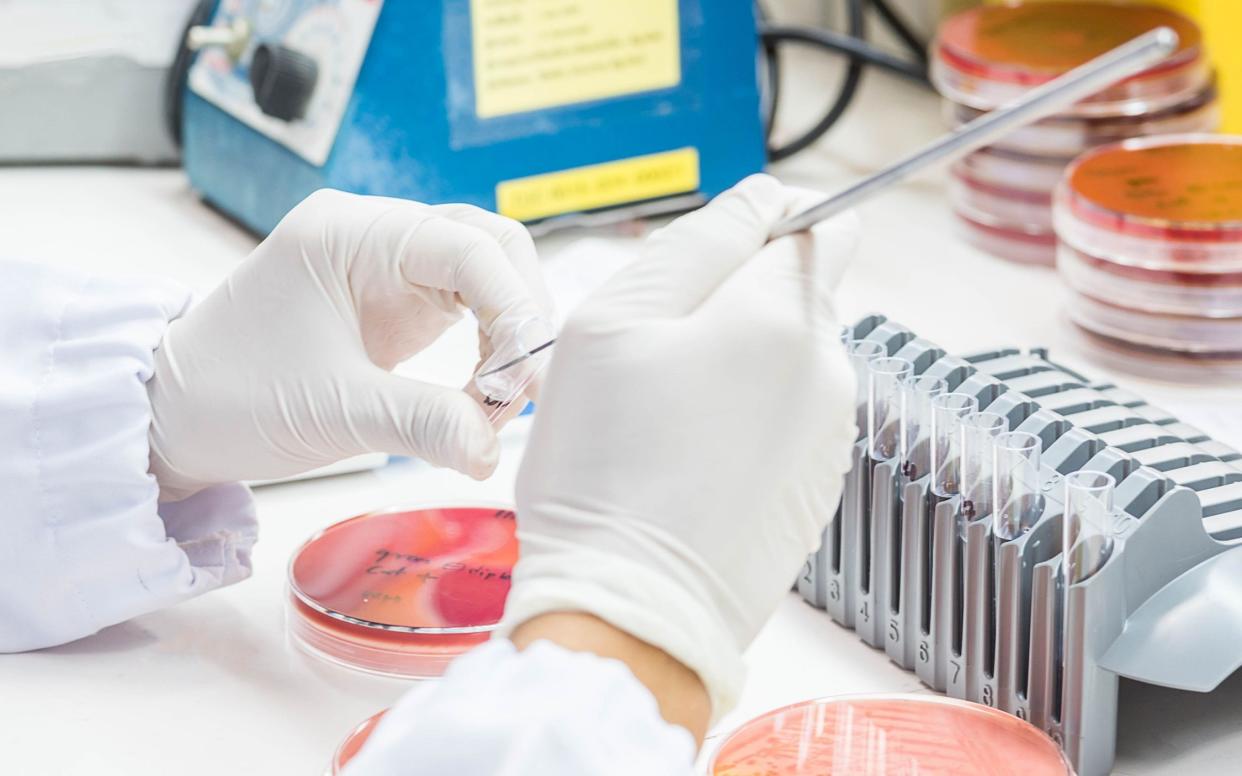 एआईले ४८ घण्टामा समाधान गरिदियो ‘सुपरबग’ को रहस्य, वैज्ञानिकहरू हैरान