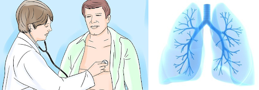 झापामा भेटिए ६१६ नयाँ क्षयरोगी, समुदायस्तरमा फैलन नदिन के गर्ने ?