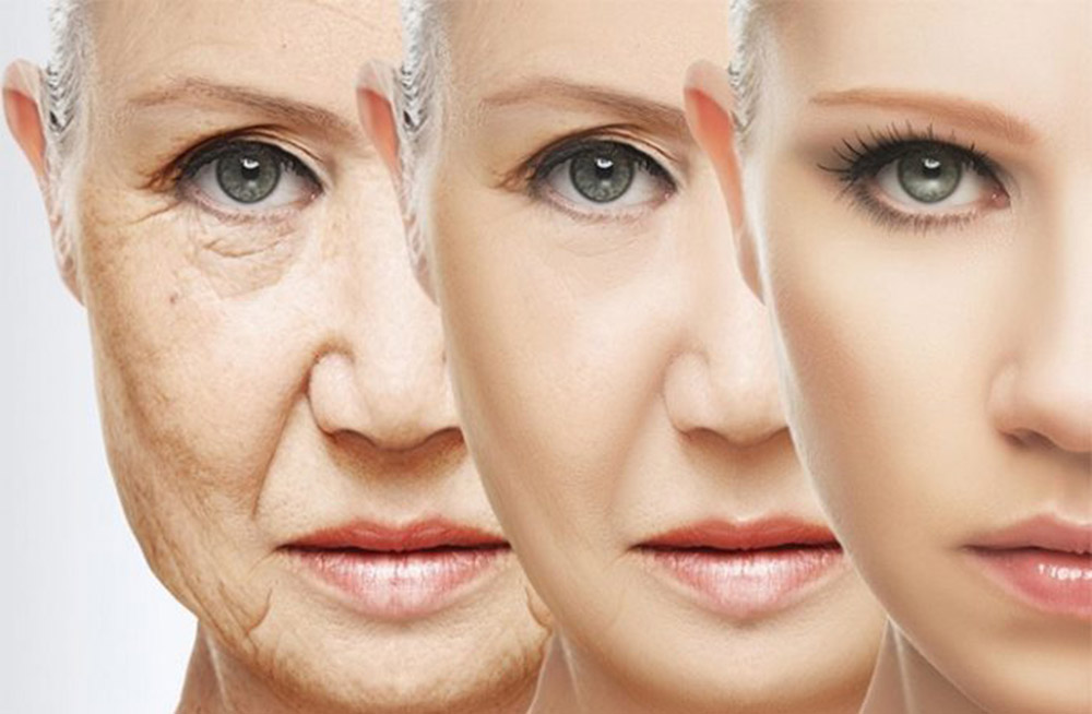 चाउरिएको छालाा हाटाउने ५ घरेलु उपाय