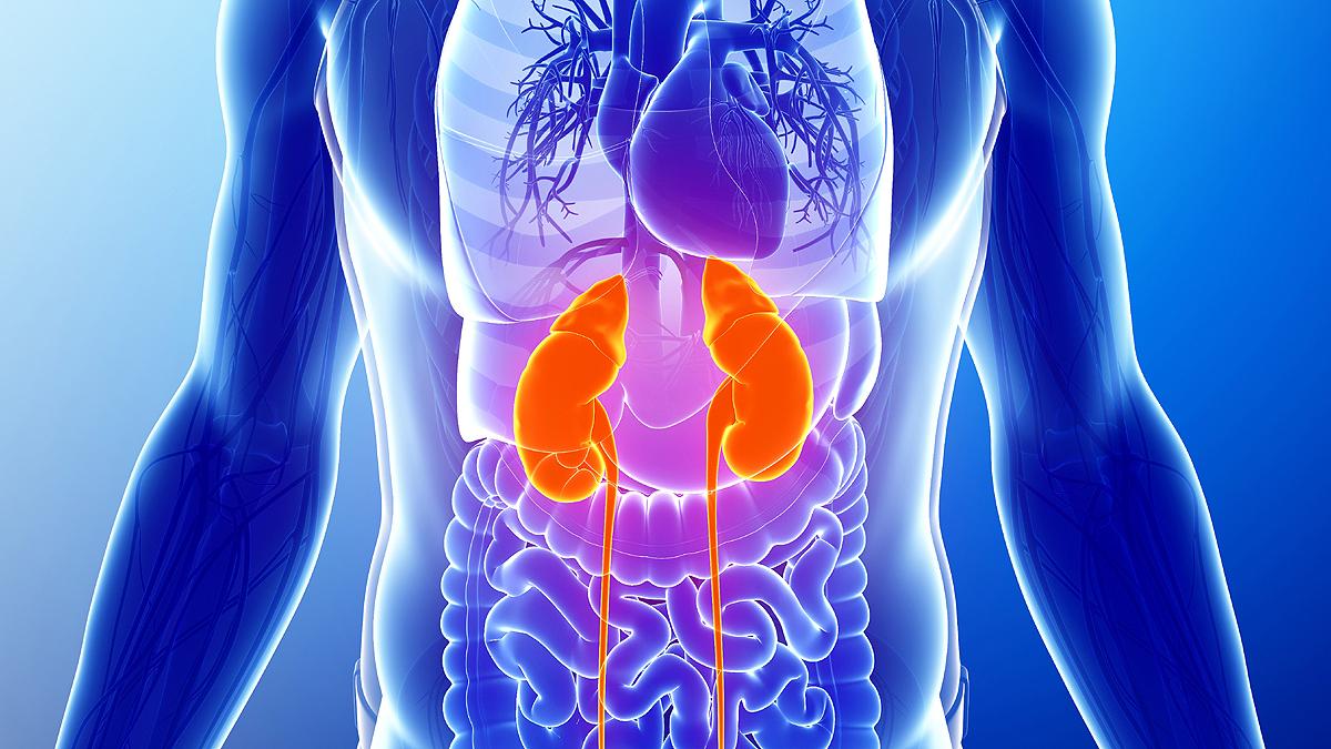 मिर्गौला स्वस्थ राख्ने ५ घरेलु उपाय