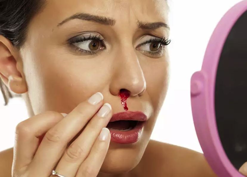 नाकबाट रगत आउँदा के गर्ने र के नगर्ने ?