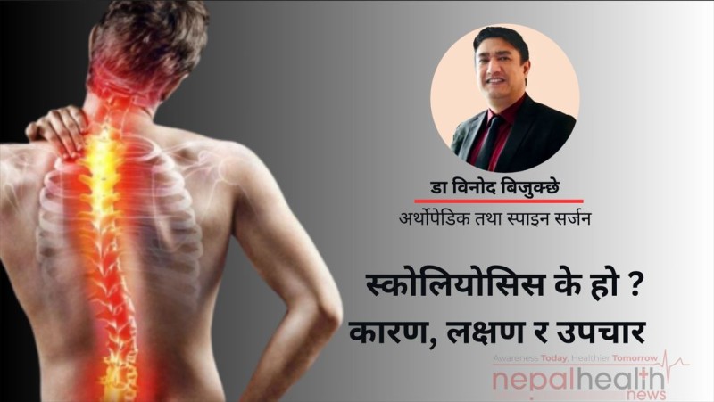 स्कोलियोसिस के हो ? कारण, लक्षण र उपचार