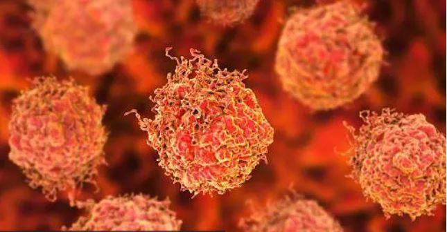 प्रोस्टेट क्यान्सर के हो र किन विश्वभर यसको केसहरू बढिरहेका छन् ?