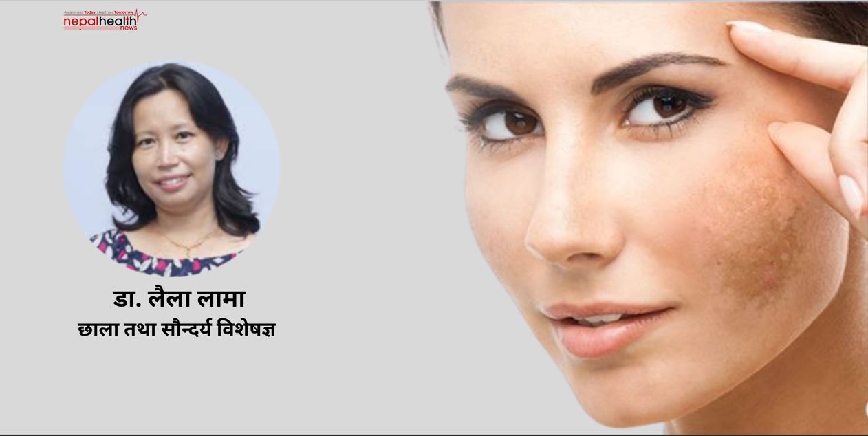 अनुहारको सौन्दर्य र चायापोतो