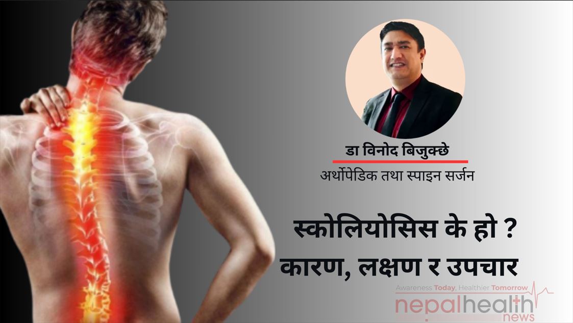स्कोलियोसिस के हो ? कारण, लक्षण र उपचार