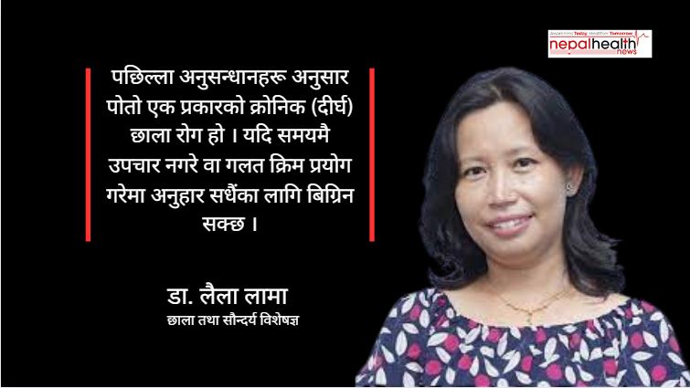 अनुहारको सौन्दर्य र चायापोतो