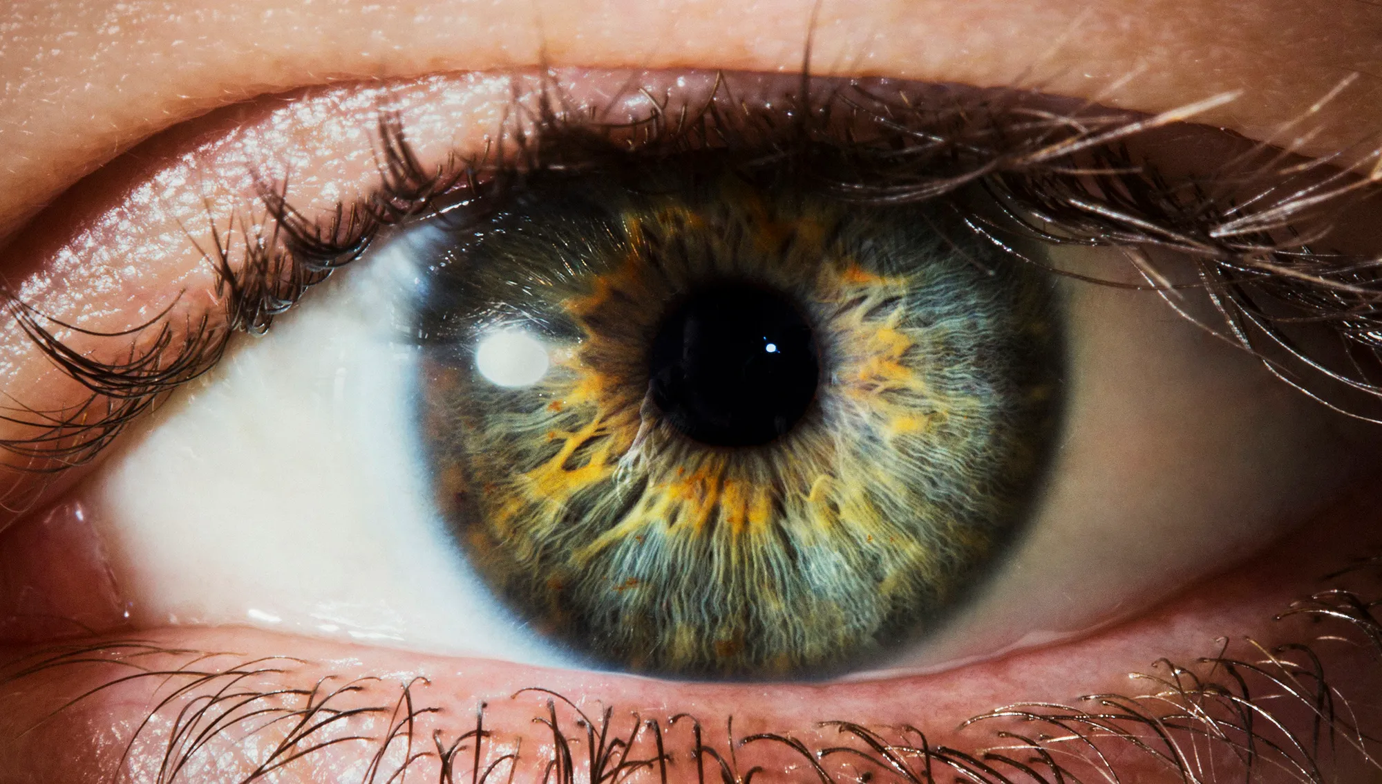 आँखा पाक्ने सङ्क्रमण बढ्दै गएपछि विद्यालय बन्द