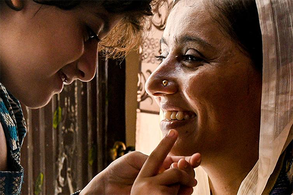 अन्तर्राष्ट्रिय प्रसूति फिस्टुला अन्त्य दिवस: नेपालमा अझै हजारौं महिला प्रभावित