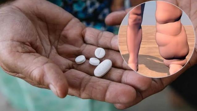 बाँकेमा  हात्तीपाइले विरुद्धको १० दिने औषधि सेवन अभियान सुरु