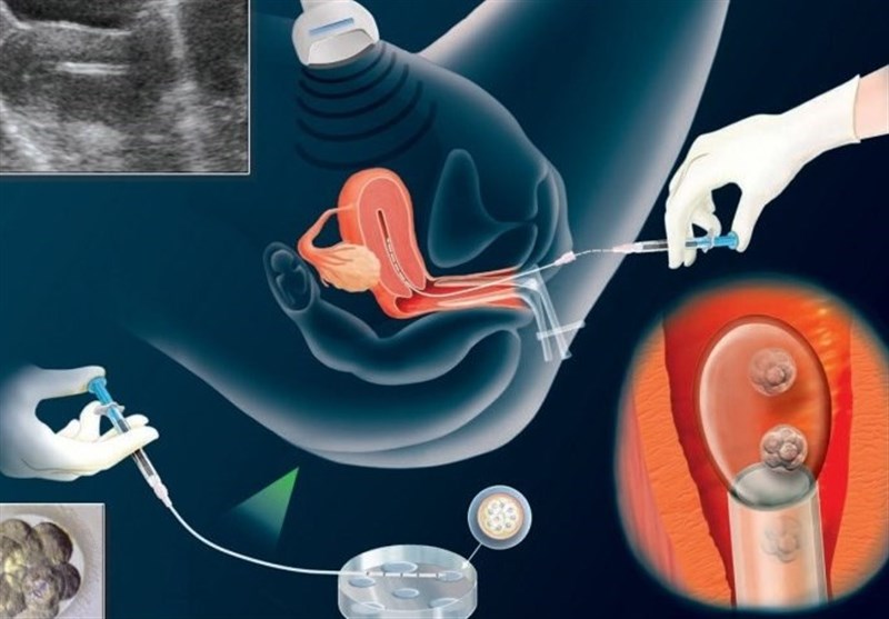 सपना जन्मिन्छन् तर गर्भ बस्दैन