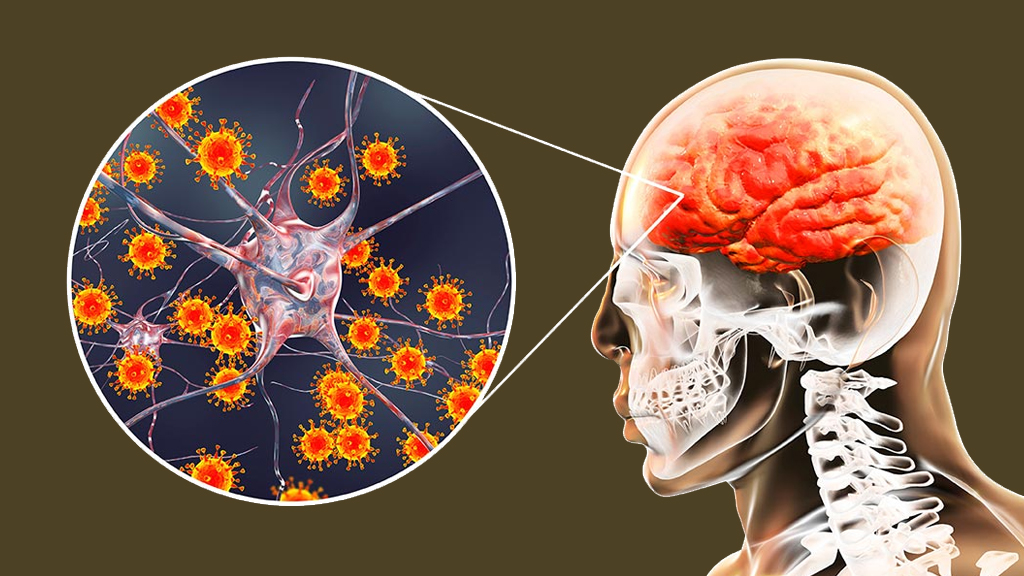 तराई क्षेत्रमा फैलिन थाल्यो जापानी इन्सेफ्लाइटिस: तीन जनाको मृत्यु,३३ संक्रमित
