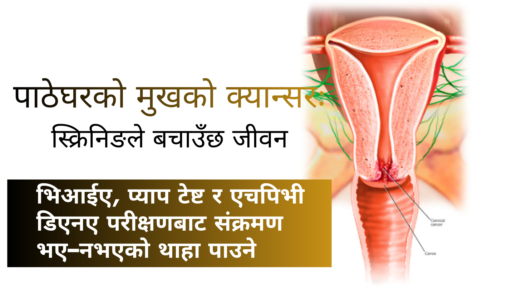 पाठेघरको मुखको क्यान्सरः स्क्रिनिङले बचाउँछ जीवन