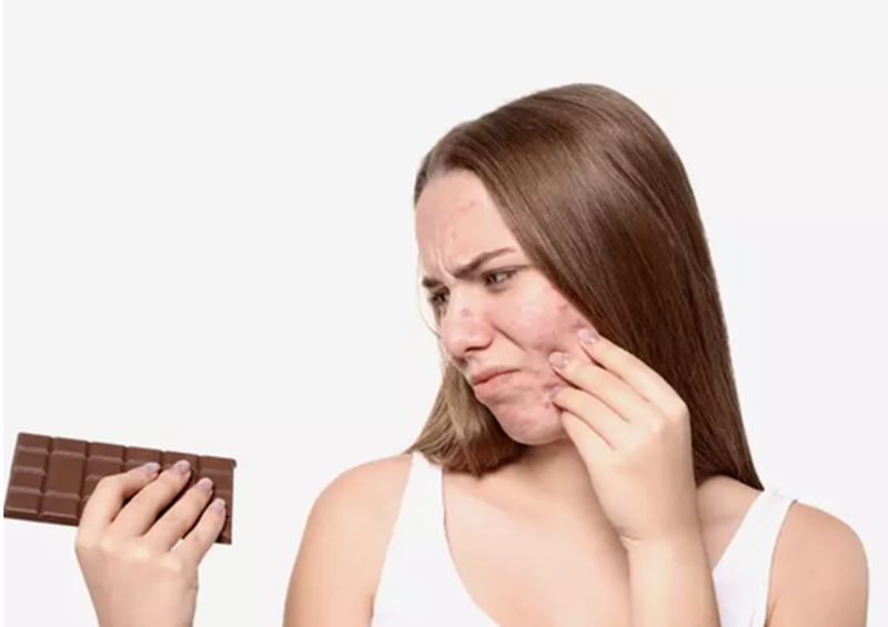 के चकलेट खाँदा डन्डीफोर आउँछ ? वा त्यो भ्रम मात्रै हो