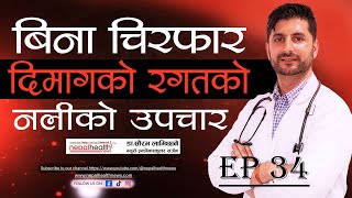 के तपाईंलाई स्ट्रोक र ब्रेन ह्यामरेज भयो ? अब इन्डोभास्कुलर प्रविधिबाट सजिलै उपचार