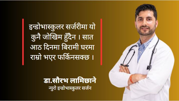 बिना चिरफार  दिमागको रगतको नलीको उपचार